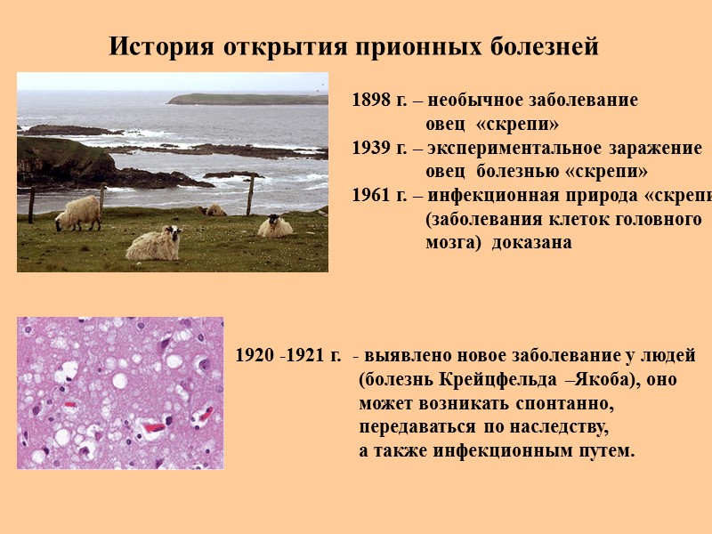 История открытия прионных болезней 1898 г. – необычное заболевание     